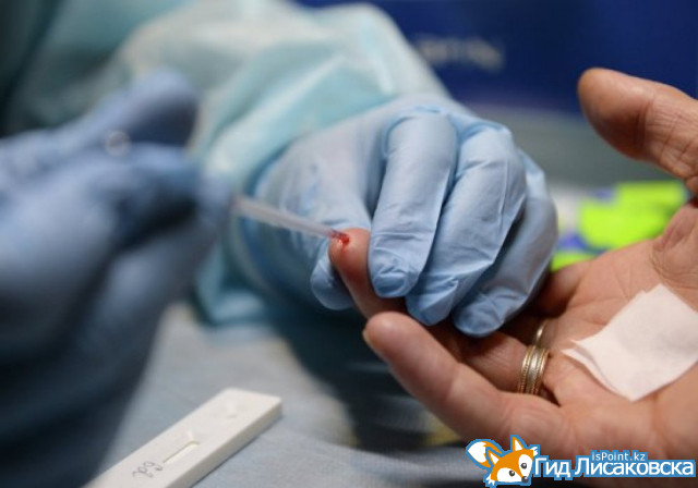 В Костанайской области почти на 40% выросла заболеваемость ВИЧ